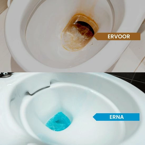 Needum ® Toiletblokjes Voor Inbouwreservoirs – WC-blokjes – Toiletblokken In Een Voordeelverpakking – 30 Stuks 2 Needum ® Toiletblokjes Voor Inbouwreservoirs – WC-blokjes – Toiletblokken In Een Voordeelverpakking – 30 Stuks - Afbeelding 2